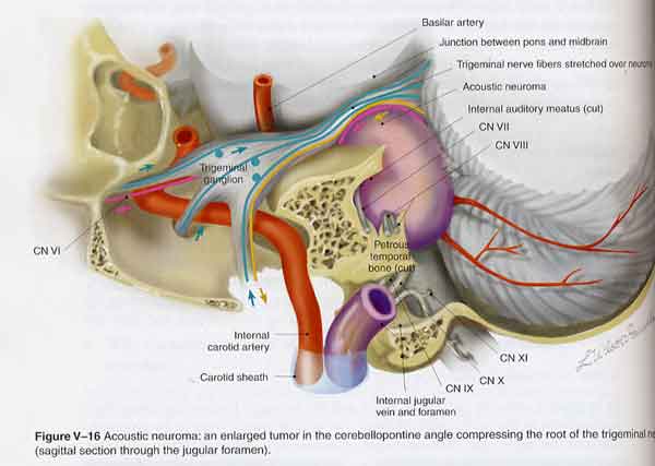 Cranial Nerves in Health and Disease (Book and CD-ROM)