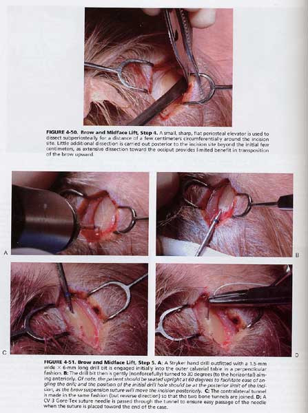 Comprehensive Facial Rejuvenation: A Practical and Systemati