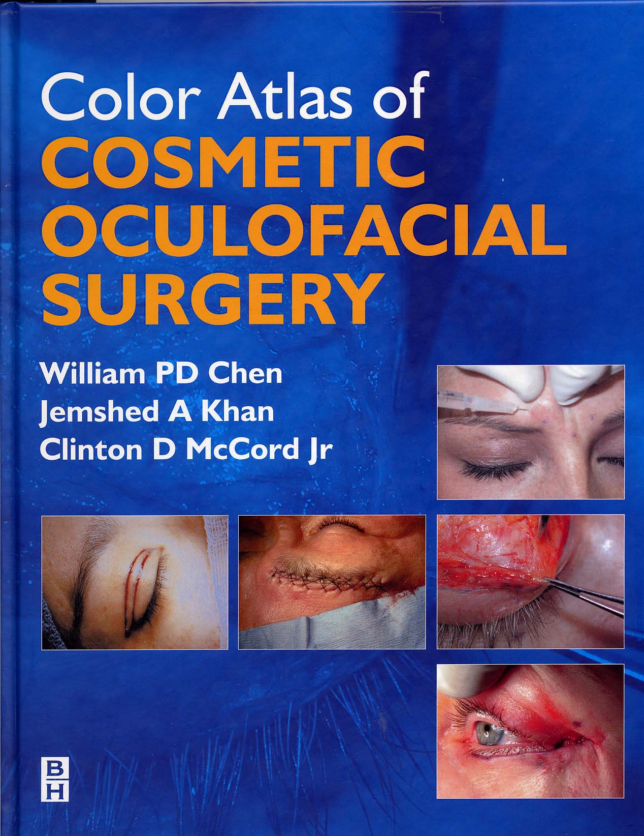 Color Atlas Of Cosmetic Oculofacial Surgery