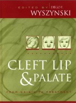 Cleft Lip and Palate: From Origin to Treatment