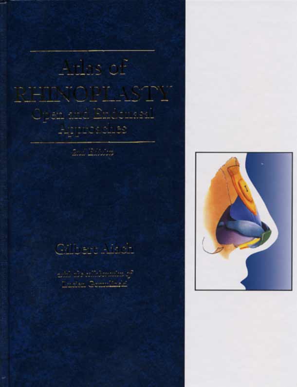 Atlas of Rhinoplasty : Open and Endonasal Approaches