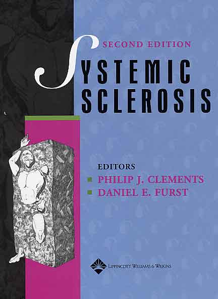 Systemic Sclerosis