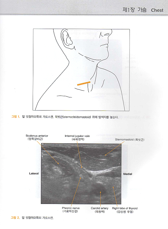 근골격계 초음파해부학 : Atlas of Musculoskeletal Ultrasound