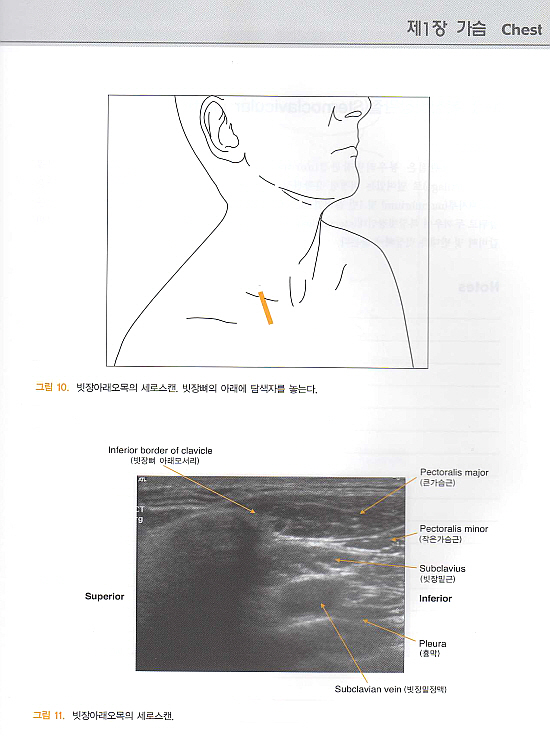 근골격계 초음파해부학 : Atlas of Musculoskeletal Ultrasound