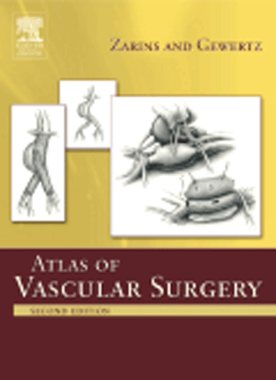 Atlas Of Vascular Surgery 2/e