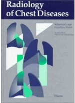 Radiology of Chest Diseases