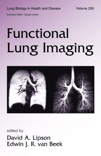 Functional Lung Imaging (Lung Biology in Health and Disease)