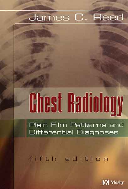 Chest Radiology - Plain Film Patterns and Differential Diagn