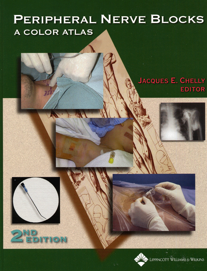 Peripheral Nerve Blocks: A Color Atlas 2th