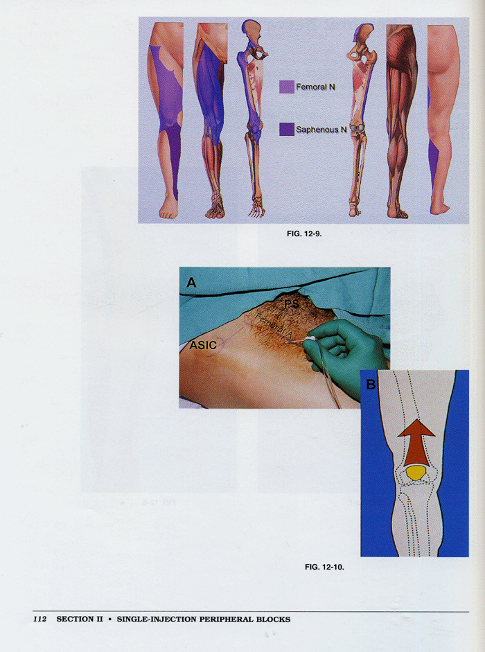 Peripheral Nerve Blocks: A Color Atlas 2th