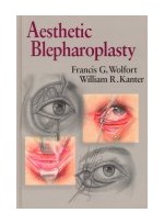 Aesthetic Blepharoplasty