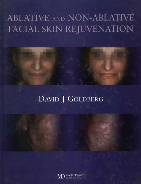 Ablative and Non-Ablative Facial Skin Rejuvenation