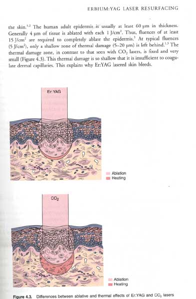 Ablative and Non-Ablative Facial Skin Rejuvenation