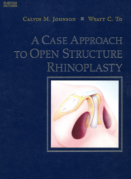 A Case Approach to Open Structure Rhinoplasty 1/e
