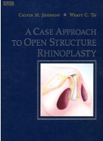 A Case Approach to Open Structure Rhinoplasty 1/e