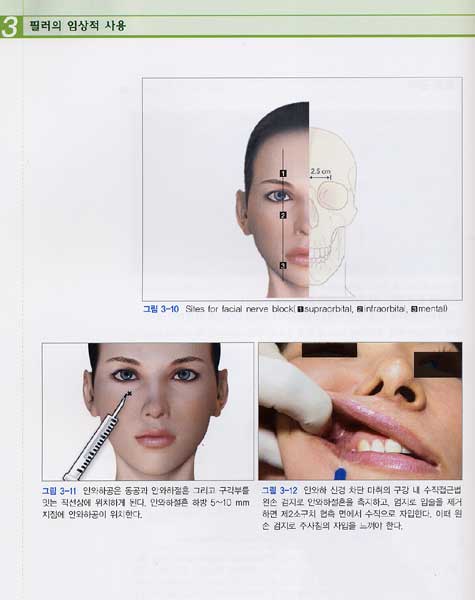 필러의 임상적 사용 : Filler in Facial Rejuvenation