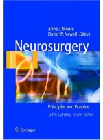 Neurosurgery