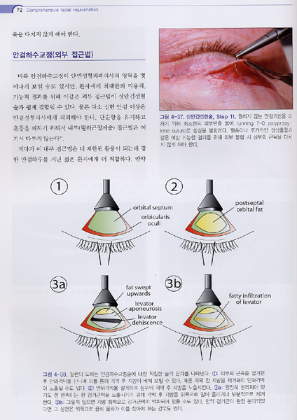 안면부 미용성형 -회춘의 술기와 임상 적용-