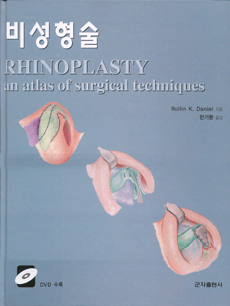 비성형술(RHINOPLASTY an atlas of surgical techniques)