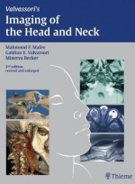 Imaging of the Head and Neck, 2e