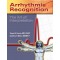 Arrhythmia Recognition: The Art of Interpretation