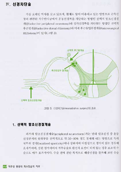 척추성 통증의 최소침습적 치료