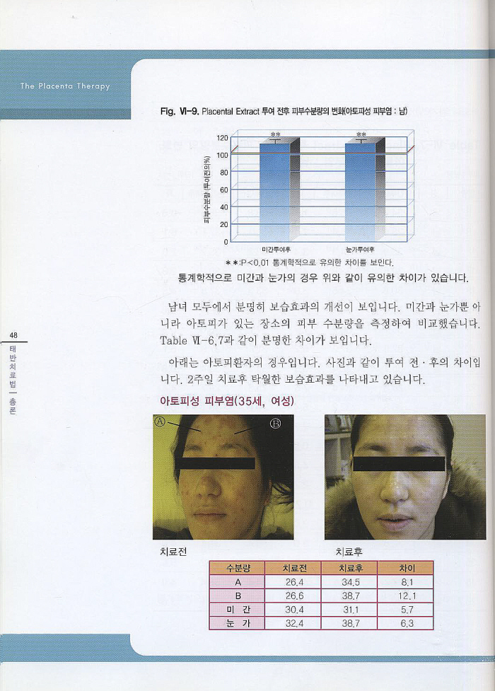 태반의 임상적 실제 : The Placenta Therapy