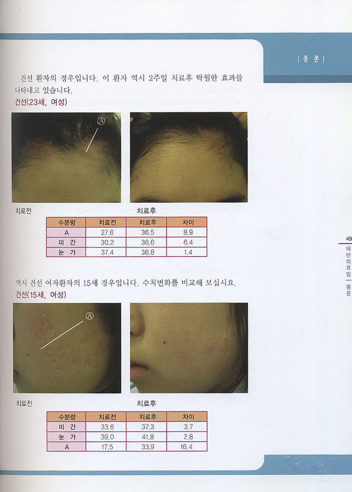 태반의 임상적 실제 : The Placenta Therapy