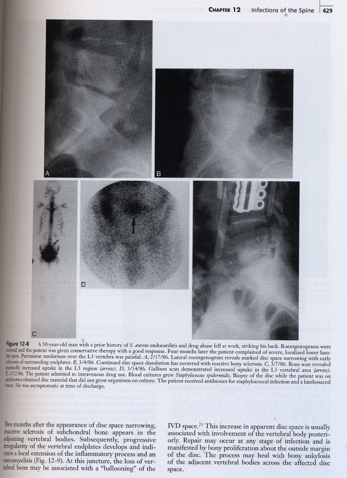 Low Back and Neck Pain : Comprehensive Diagnosis and Management 3th