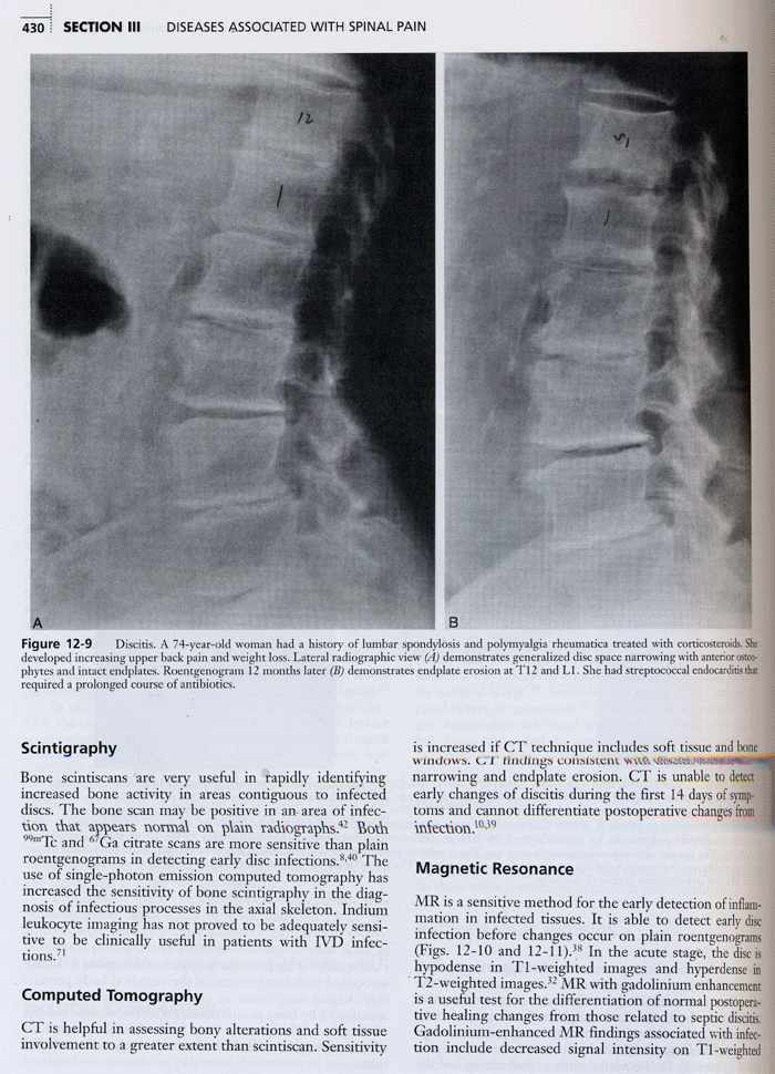 Low Back and Neck Pain : Comprehensive Diagnosis and Management 3th