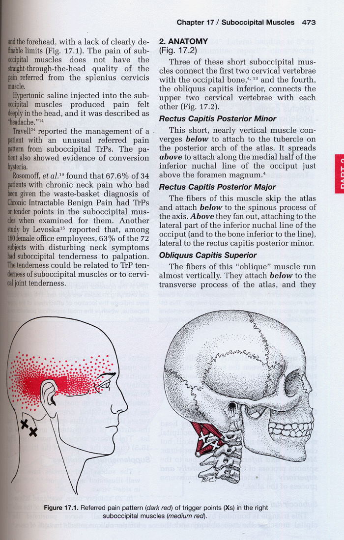Travell & Simons Myofascial Pain and Dysfunction :(1) The Trigger Point Manual Volume1. Upper Half of Body 2th