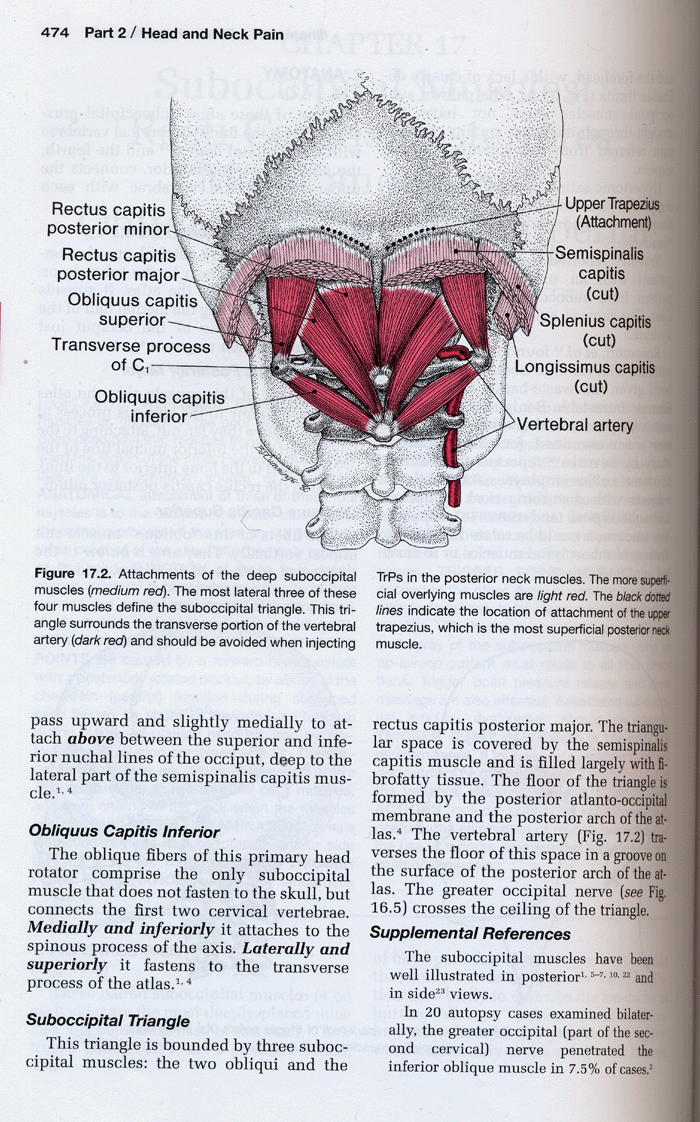 Travell & Simons Myofascial Pain and Dysfunction :(1) The Trigger Point Manual Volume1. Upper Half of Body 2th