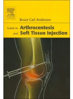 Guide to Arthrocentesis and Soft Tissue Injection
