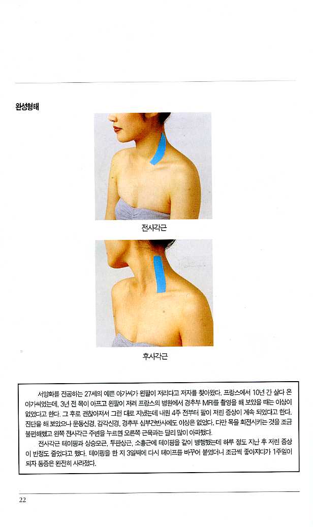 알기쉬운 키네시오 테이핑 요법