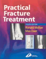 Practical Fracture Treatment