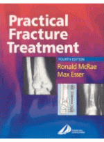 Practical Fracture Treatment