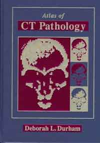 Atlas of Ct Pathology