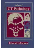 Atlas of Ct Pathology
