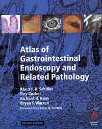 Atlas of Gastrointestinal Endoscopy and Related Pathology