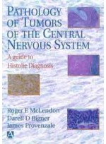 Pathology of Tumors of the Central Nervous System