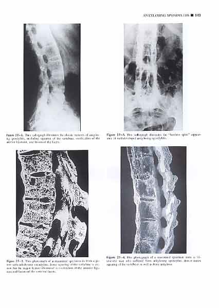 Atlas of Orthopedic Pathology(2Ed)