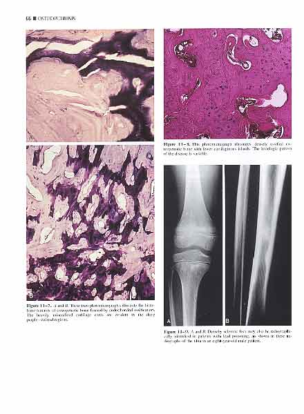 Atlas of Orthopedic Pathology(2Ed)