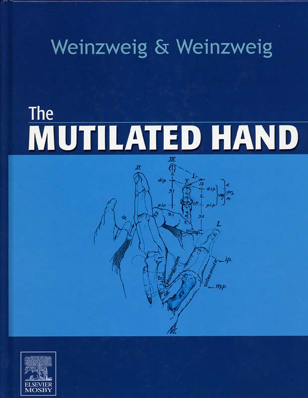 The Mutilated Hand