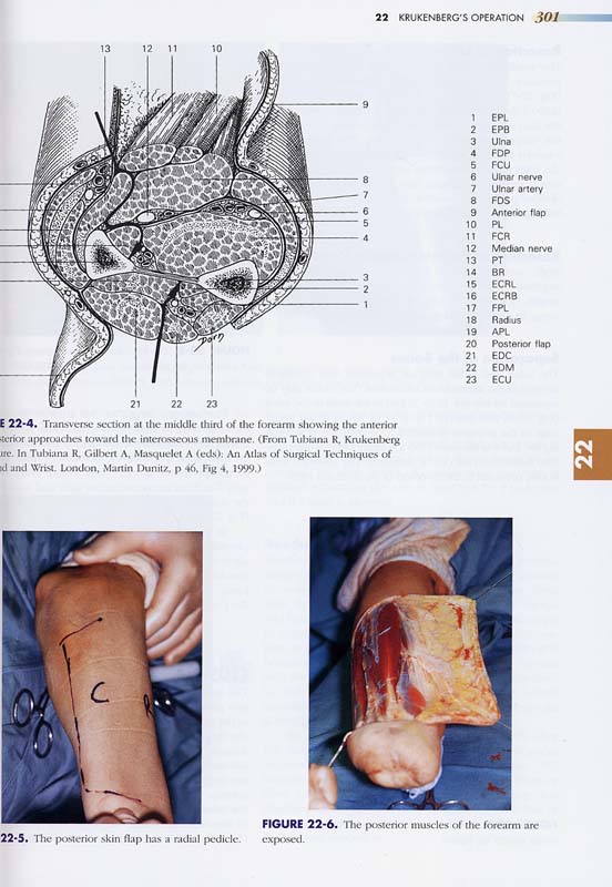 The Mutilated Hand