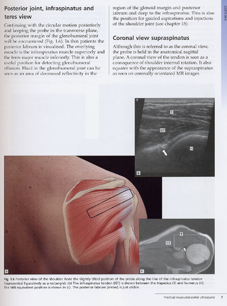 Practical Musculoskeletal Ultrasound