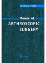 Manual of Arthroscopic Surgery