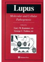 Lupus: Molecular and Cellular Pathogenesis