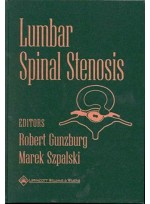 Lumbar Spinal Stenosis