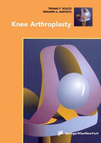 Knee Arthroplasty