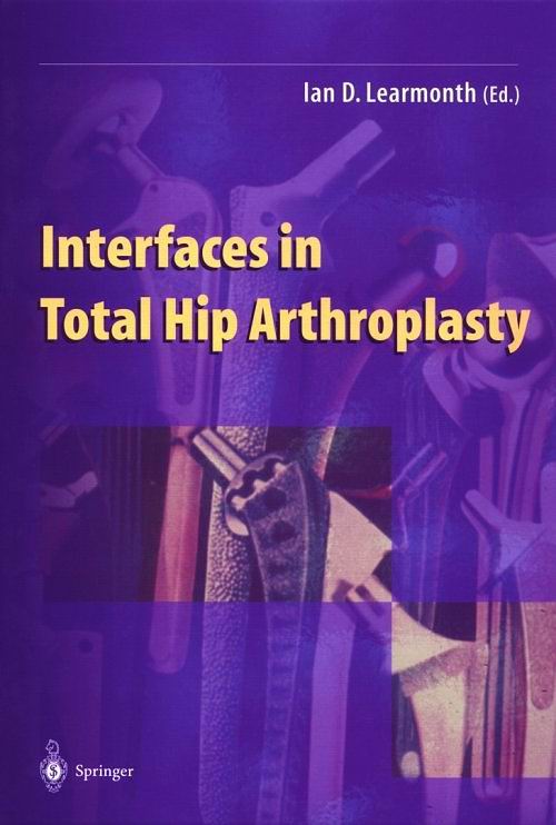 Interfaces in Total Hip Arthroplasty